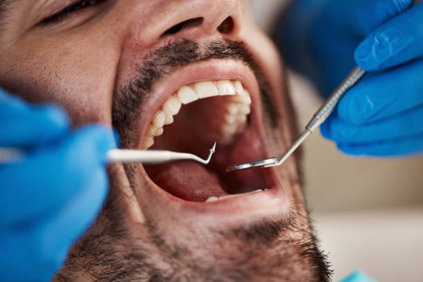 Best Emergency Gum Treatment in Fort Denaud, FL